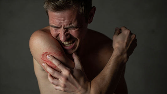 ¿Tienes molestias al mover el brazo? Cuidado, podrías estar a punto de caer en estas lesiones comunes